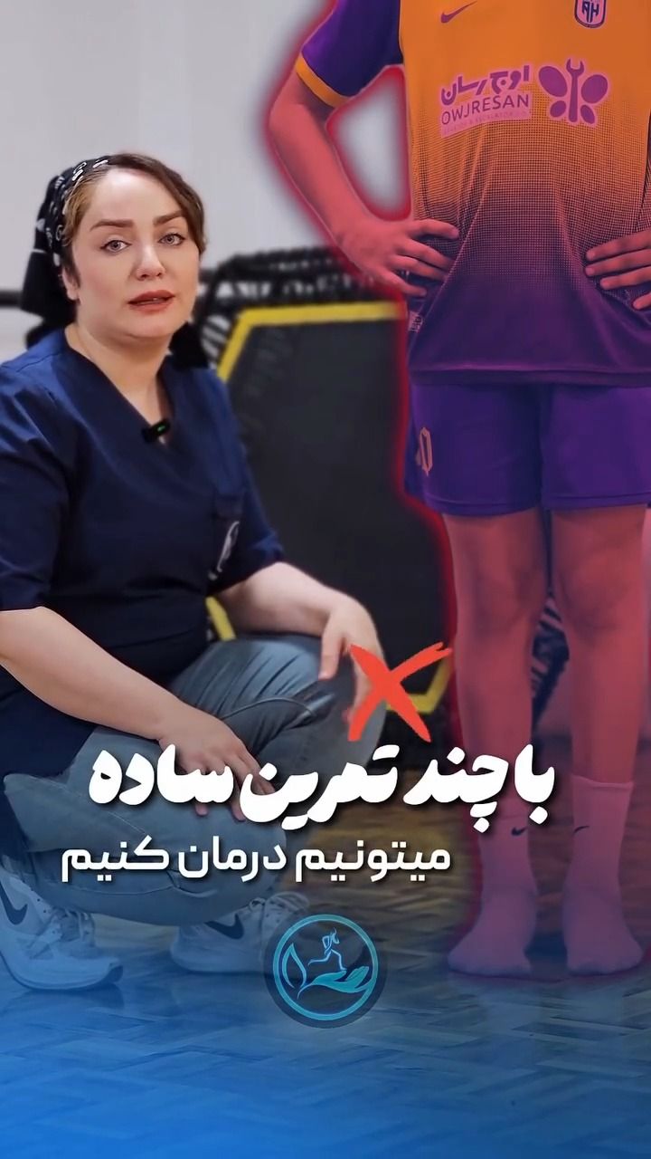 زانوی ضربدری در ورزشکاران